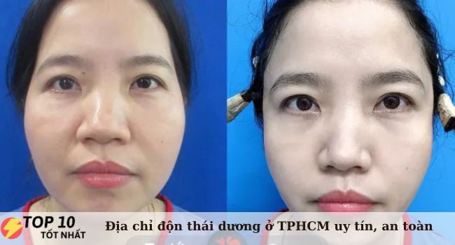 Bệnh viện thẩm mỹ Kangnam